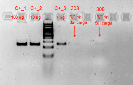 Only one step away from having my deceased Aunt’s whole genome&nbsp;sequenced